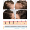 Hair Growth Wand